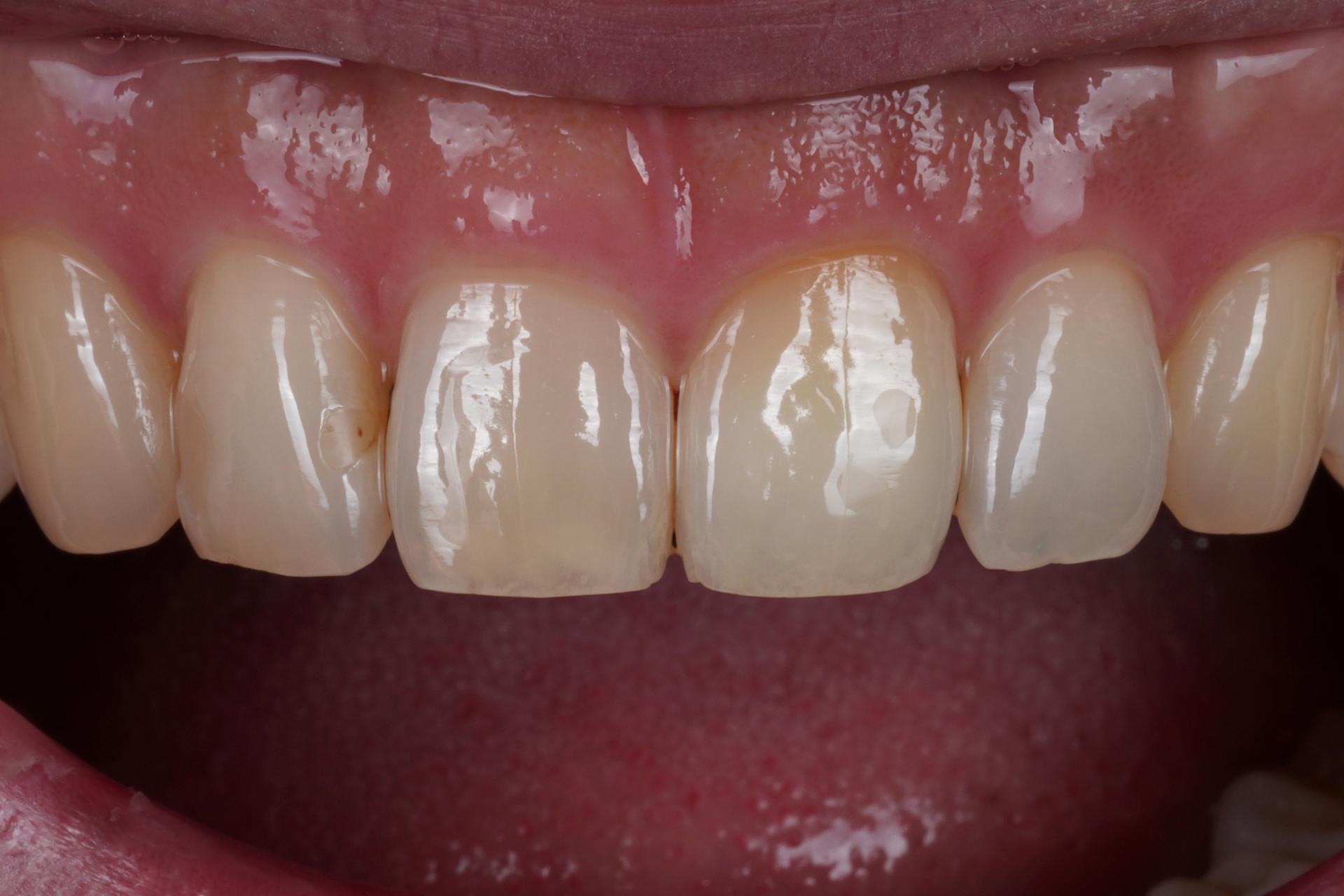 44b977acd09ef.jpg