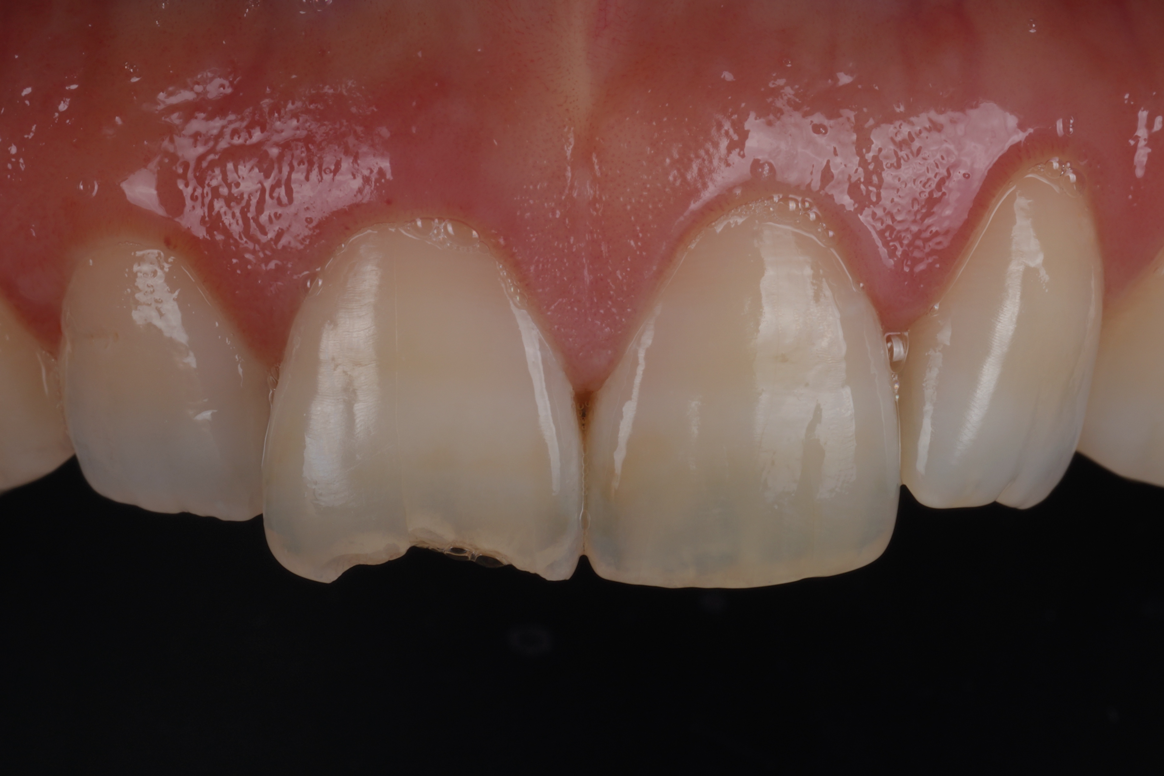 c2722a357957b.jpg