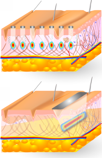 bcd345c9036bb.png