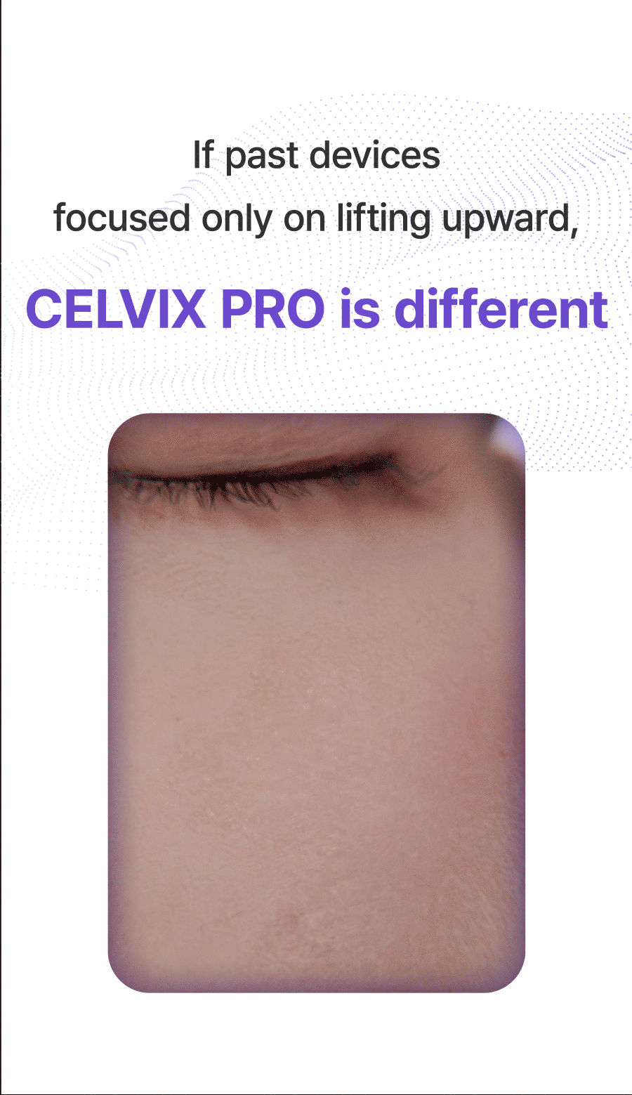 Celvix Pro
