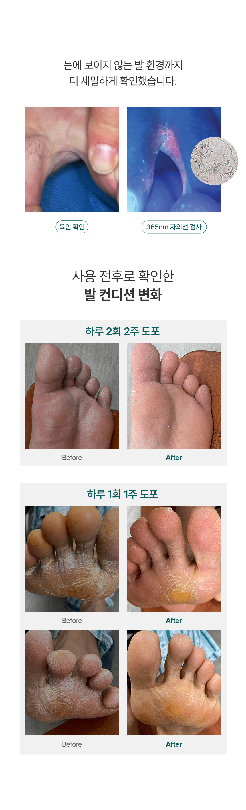 새니닥 토앤솔 풋케어 스프레이 티트리레몬그라스, 100ml, 1개