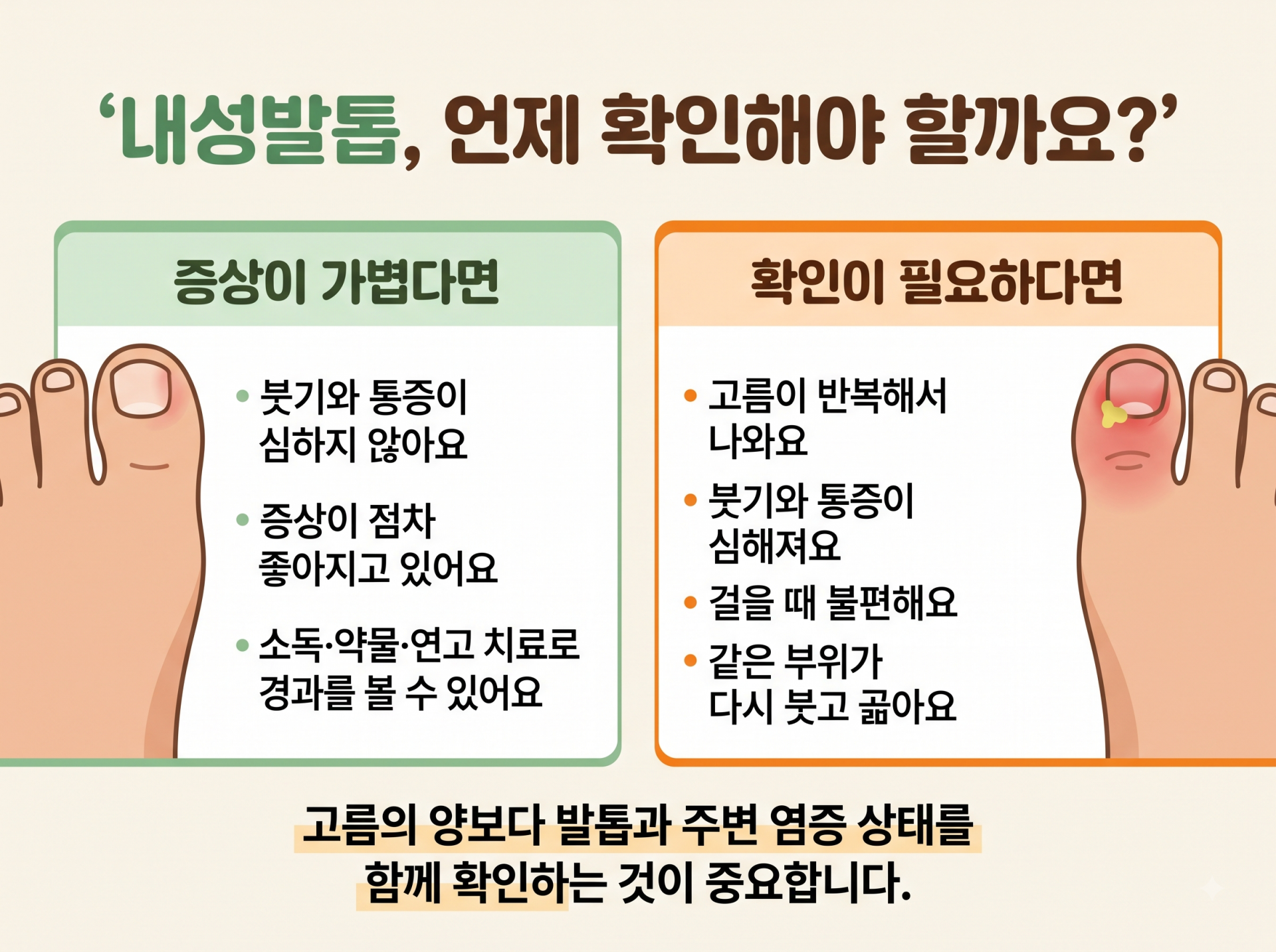 내성발톱 재발 예방을 위한 발톱 손질과 신발 선택 및 발 관리 방법