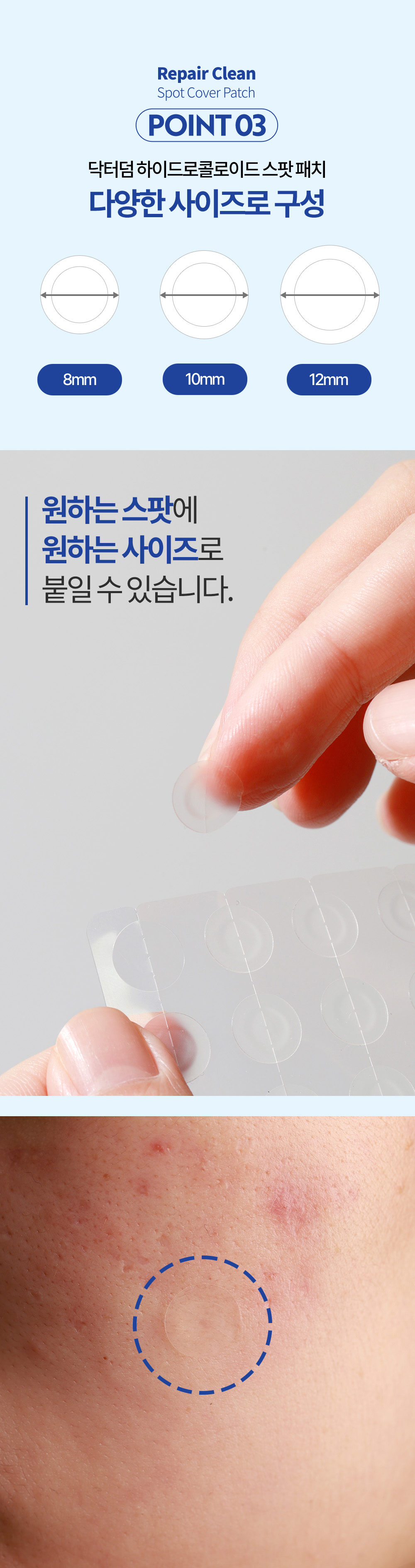 리페어 클린 스팟 커버 패치 (3박스 60개↑)