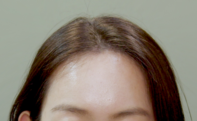 after