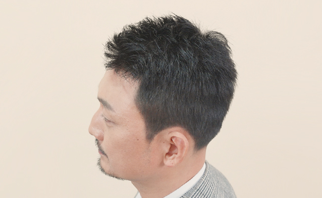 after