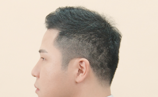 after