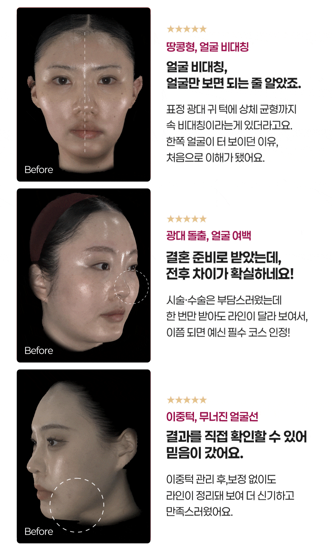 비대칭