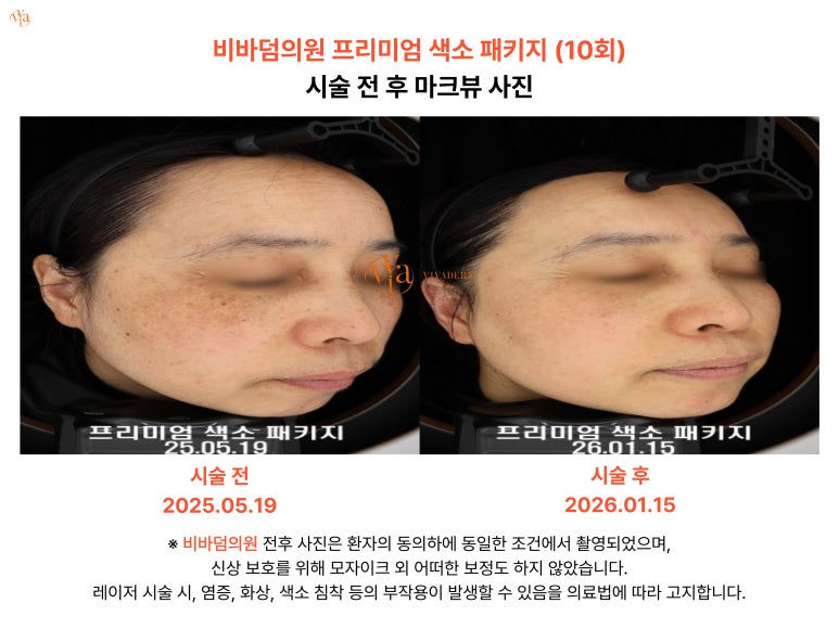 112d077064f0d.png