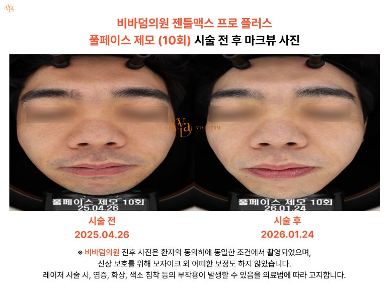 addd9626bd863.png