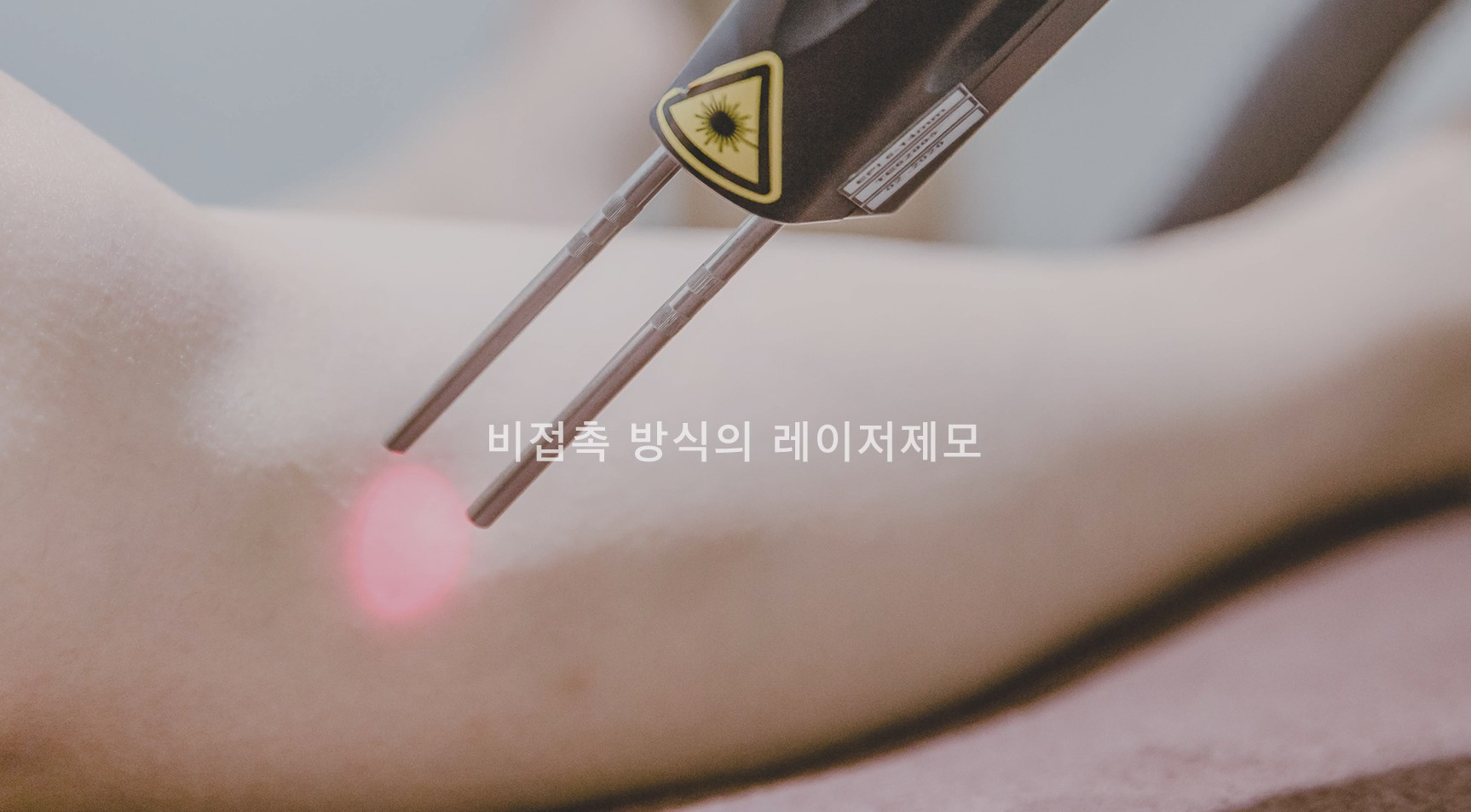 종아리 레이저제모 주기 명동피부과 닥터에버스 종아리 레이저제모 주기 명동피부과 닥터에버스