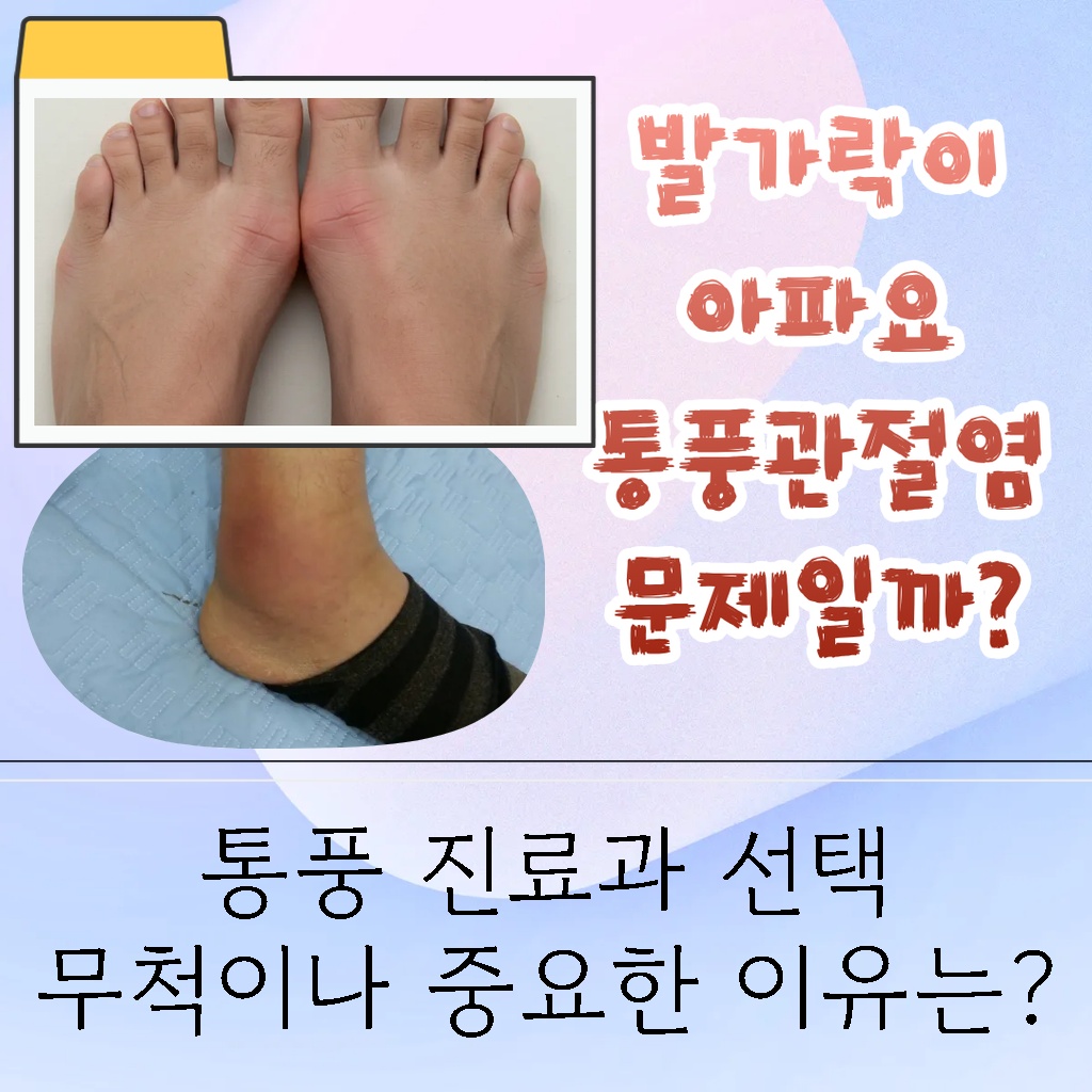 통풍 진료과 선택이 중요한 이유 설명 이미지