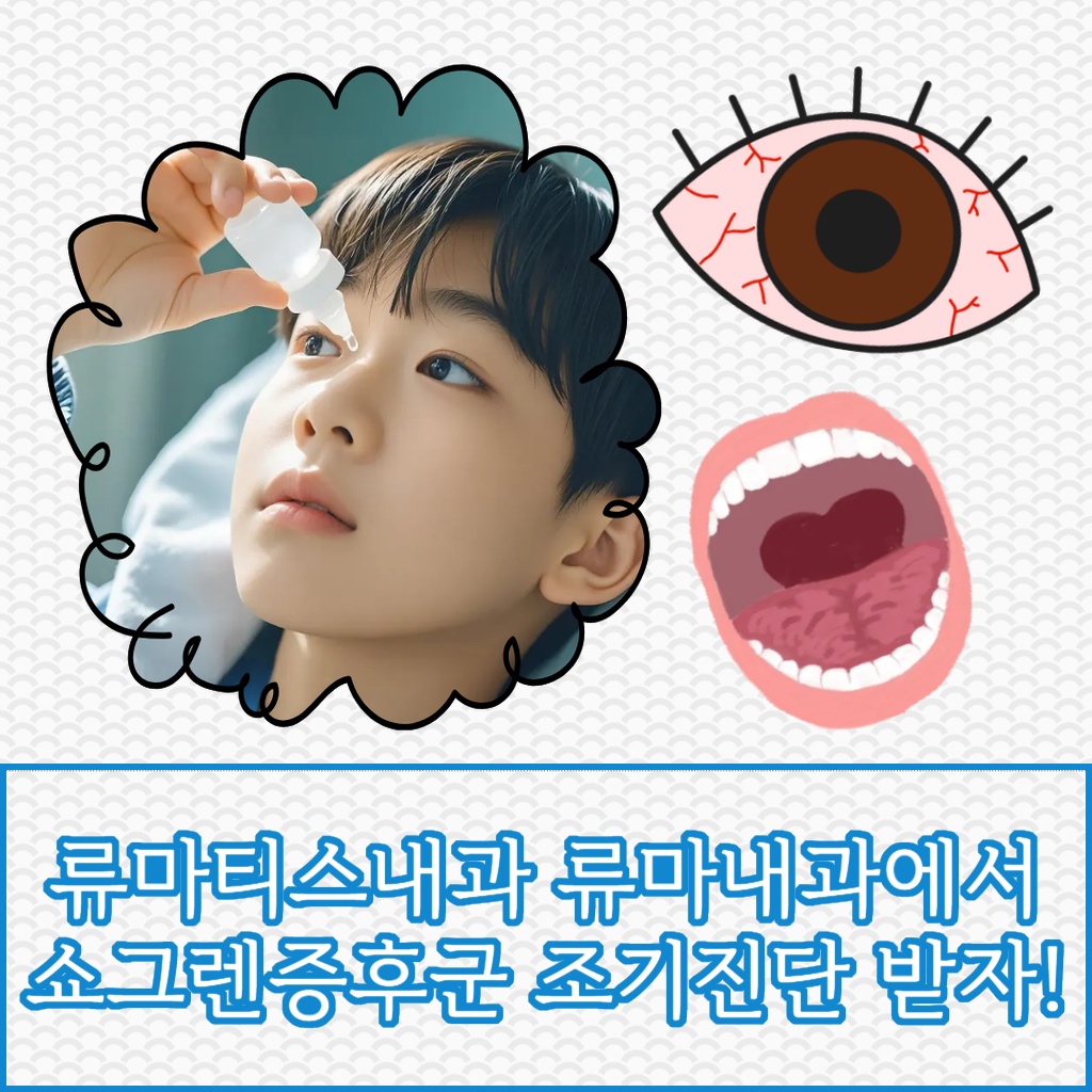 류마티스내과에서 쇼그렌증후군 조기진단을 권장하는 설명 이미지