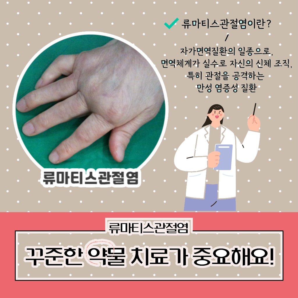 류마티스관절염 치료를 위해 꾸준한 약물 치료가 중요하다는 점을 알려주는 설명 이미지
