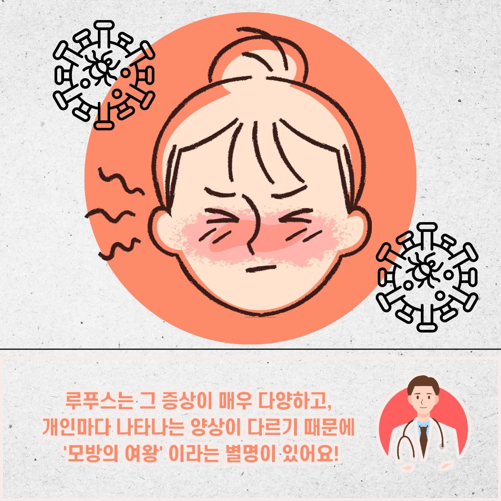 증상이 매우 다양하고 개인마다 다르게 나타나 모방의 여왕이라 불리는 루푸스 설명 이미지