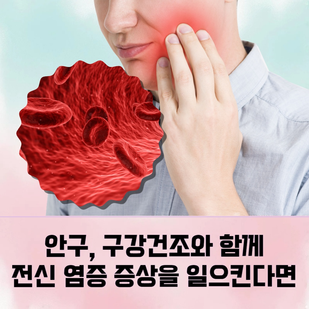 안구 및 구강 건조와 함께 전신 염증 증상이 나타나는 질환 설명 이미지