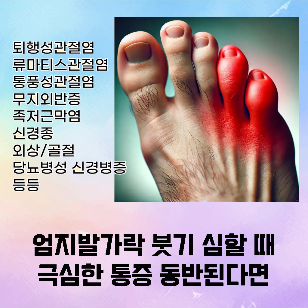 엄지발가락 붓기가 심할 때 극심한 통증이 동반되는 증상 설명 이미지