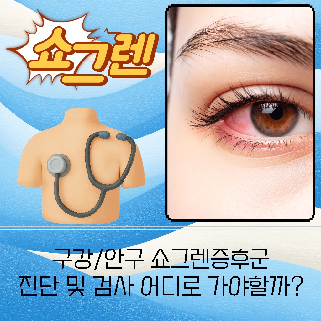 구강 및 안구 쇼그렌증후군 진단 및 검사를 위해 어디로 가야 하는지에 대한 설명 이미지