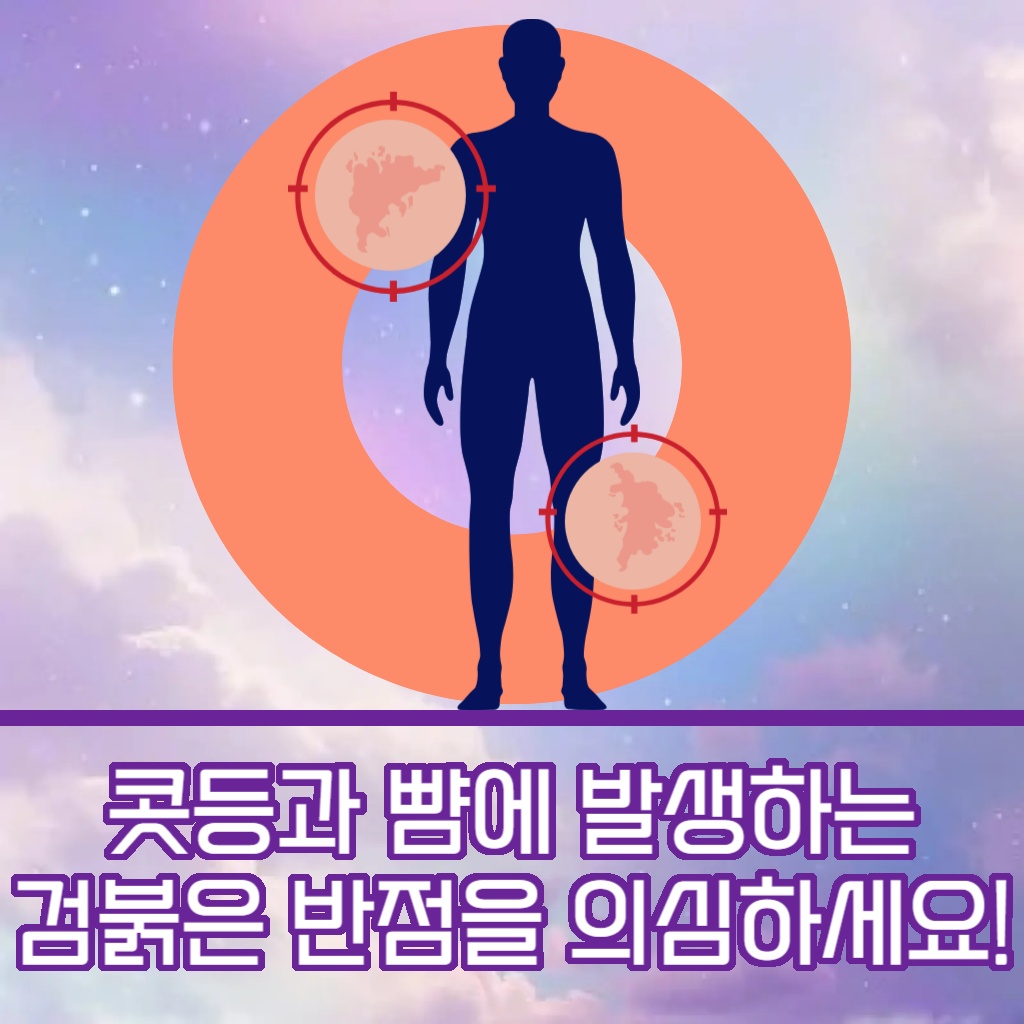 콧등과 뺨에 발생하는 검붉은 반점 설명 이미지