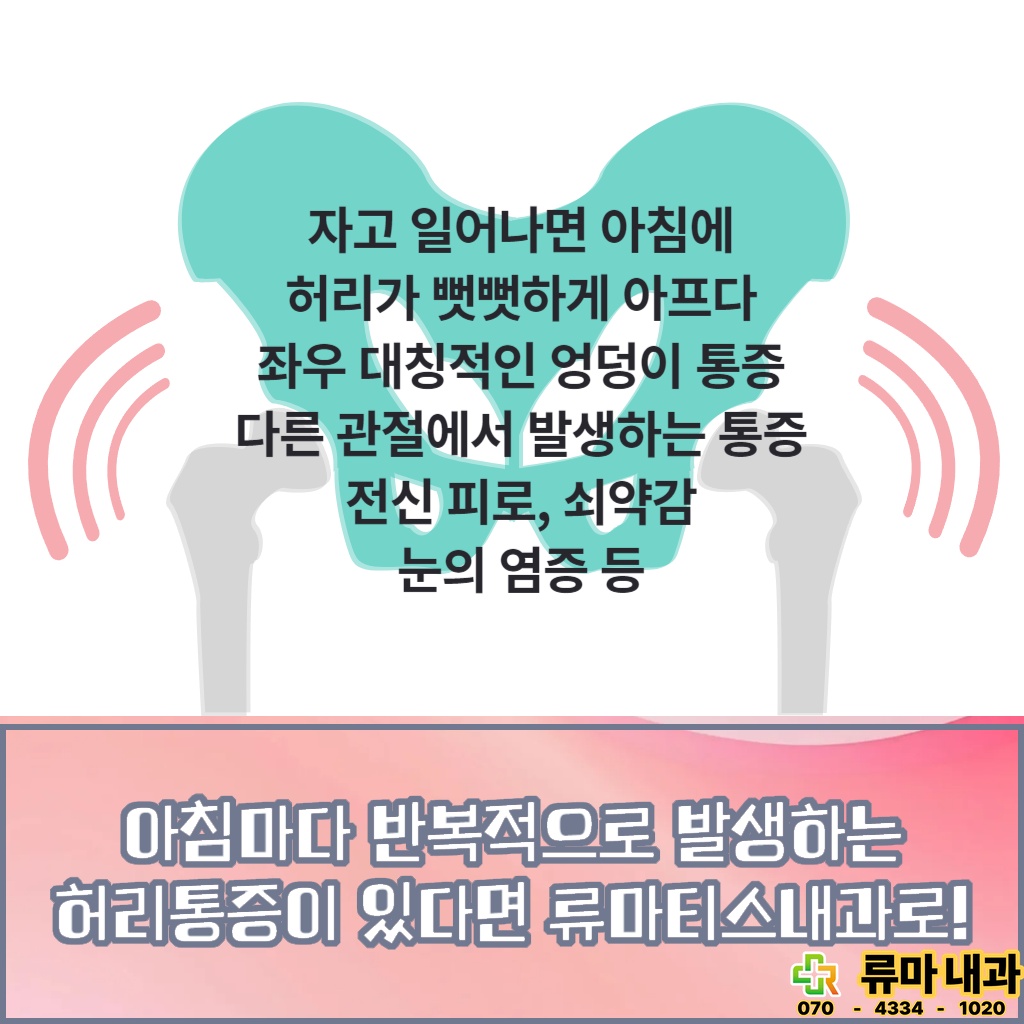 아침마다 반복적으로 허리 통증이 발생할 때 류마티스내과 방문이 필요한 이유를 나타낸 설명 이미지