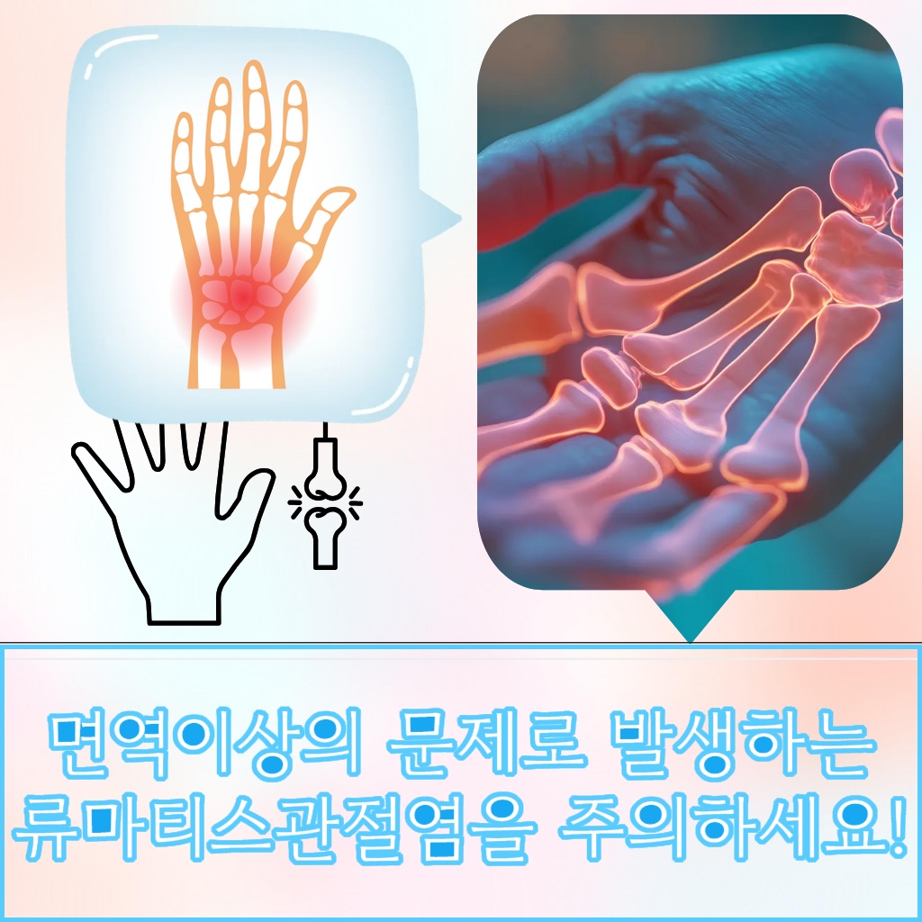 면역 이상의 문제로 발생하는 류마티스관절염 설명 이미지