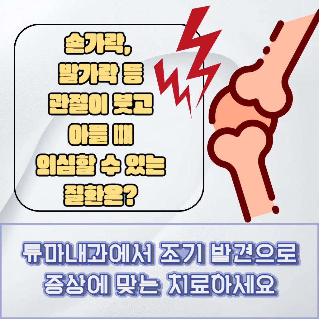 류마내과에서 조기 발견을 통해 증상에 맞는 치료를 권장하는 설명 이미지