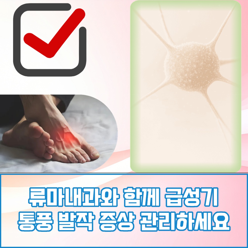 류마내과와 함께 급성기 통풍 발작 증상을 관리하는 방법을 설명하는 이미지