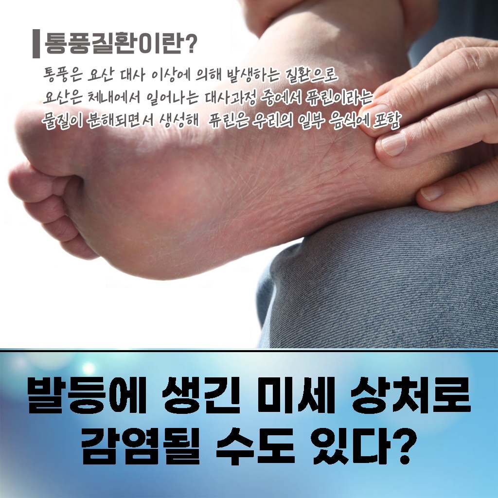 발등에 생긴 미세 상처로 감염될 수도 있다는 설명 이미지