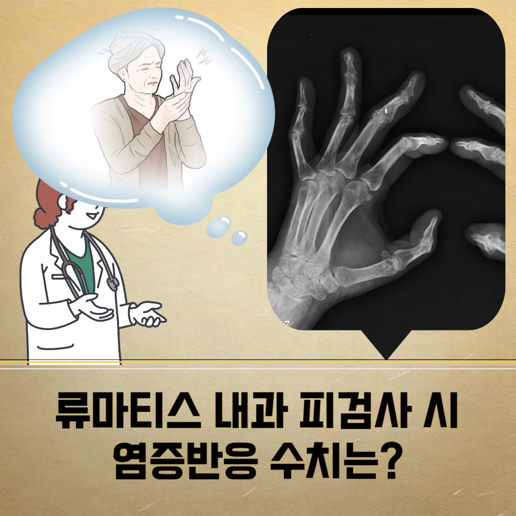 류마티스 내과 피검사 시 확인하는 염증반응 수치 설명 이미지