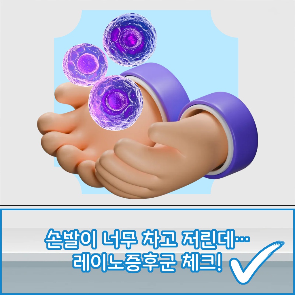 손발이 너무 차고 저린 증상이 나타나는 레이노증후군 설명 이미지