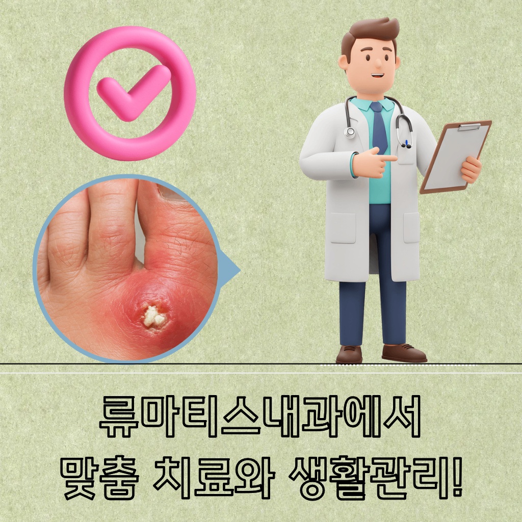 류마티스내과에서 맞춤 치료와 생활관리를 받아야 한다는 설명 이미지