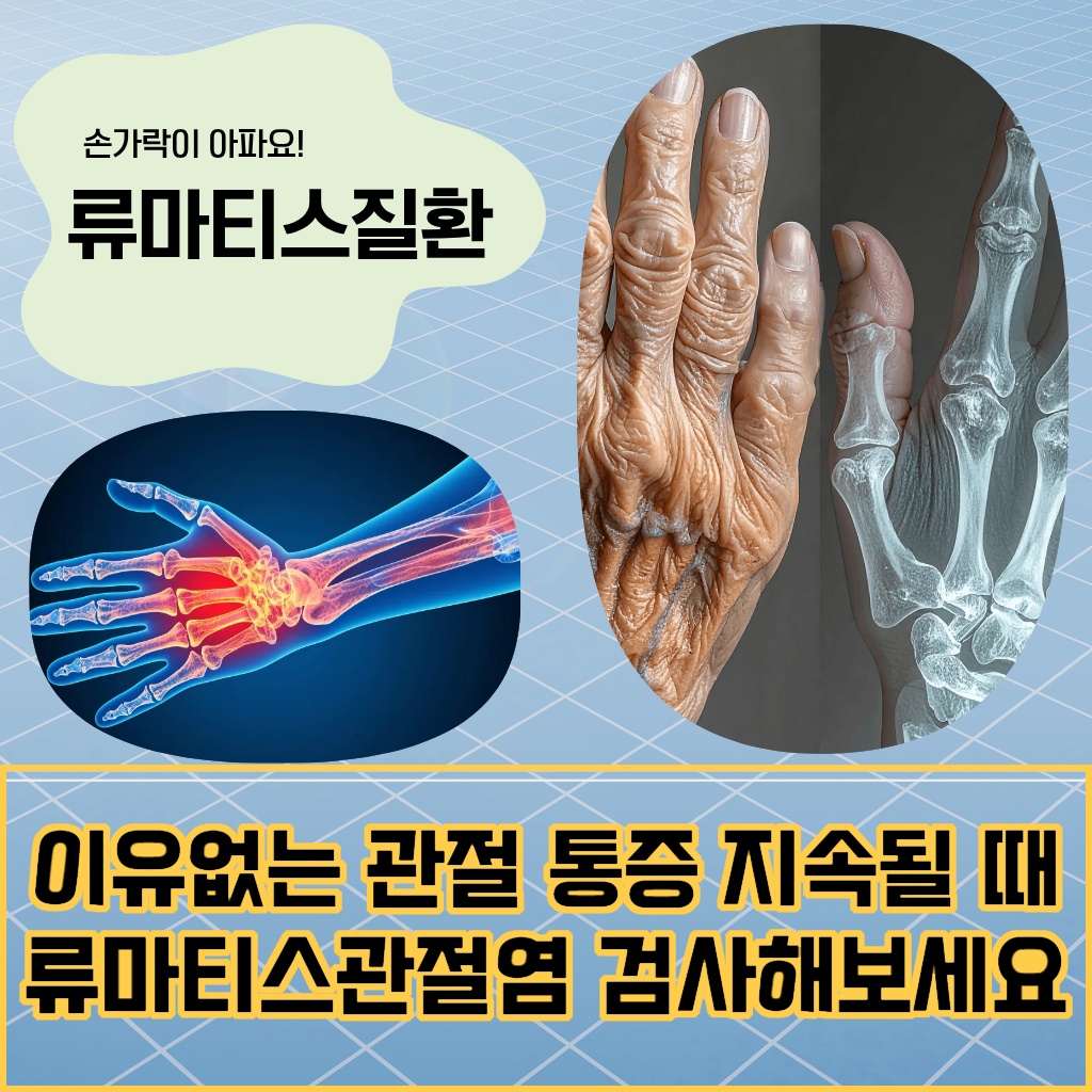 이유 없는 관절 통증이 지속될 때 류마티스관절염 검사를 권유하는 설명 이미지