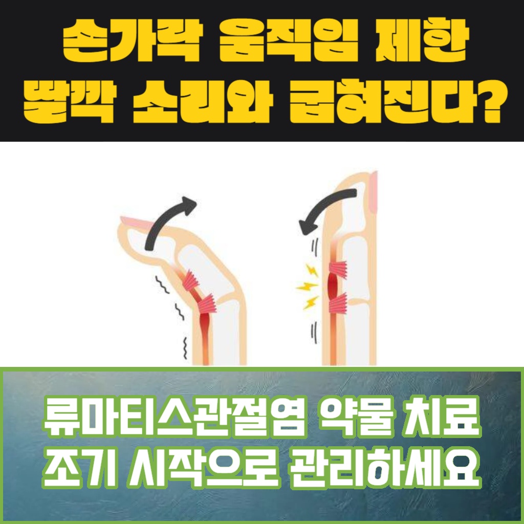 류마티스관절염은 약물 치료를 조기에 시작하여 관리해야 한다는 설명 이미지
