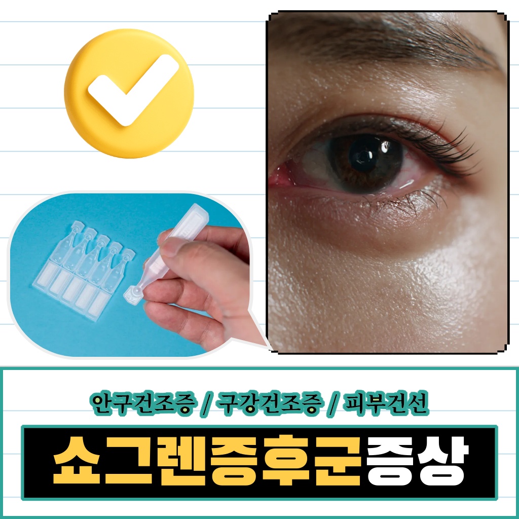 안구건조증, 구강건조증, 피부건선을 동반하는 쇼그렌증후군 증상 설명 이미지