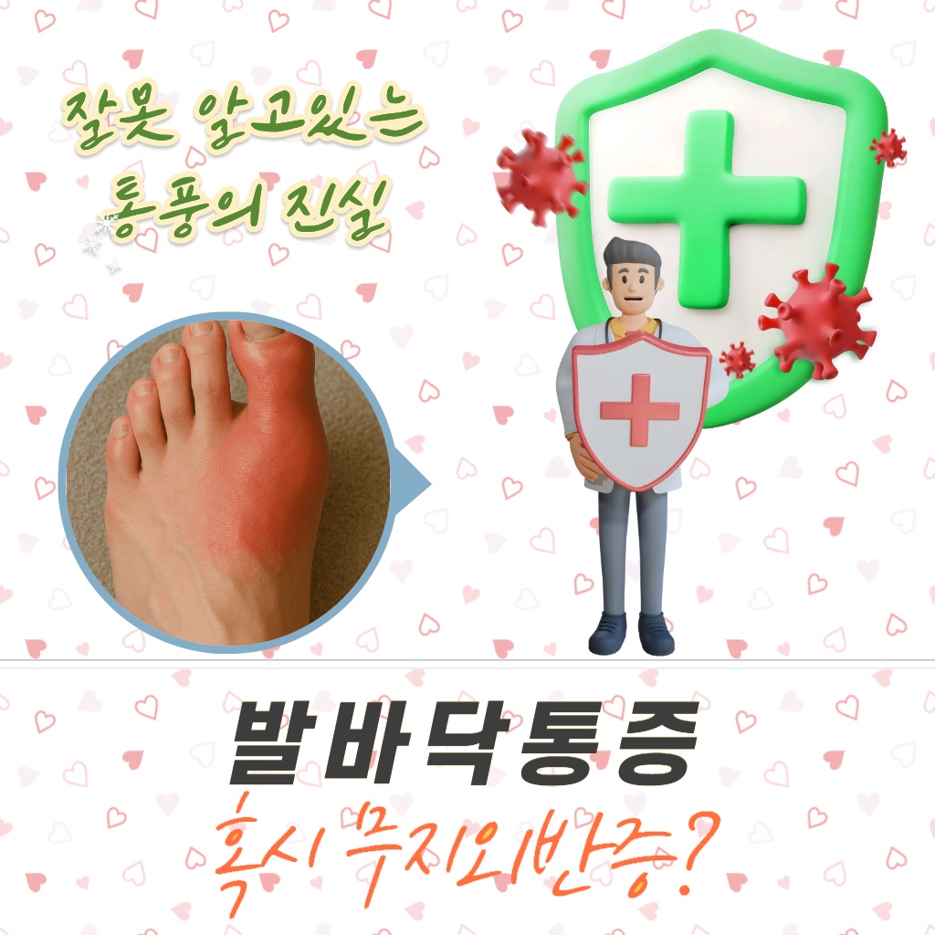 발바닥 통증의 원인이 될 수 있는 무지외반증 설명 이미지