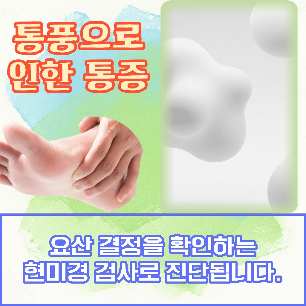 요산 결정을 현미경으로 확인해 진단하는 통풍 설명 이미지