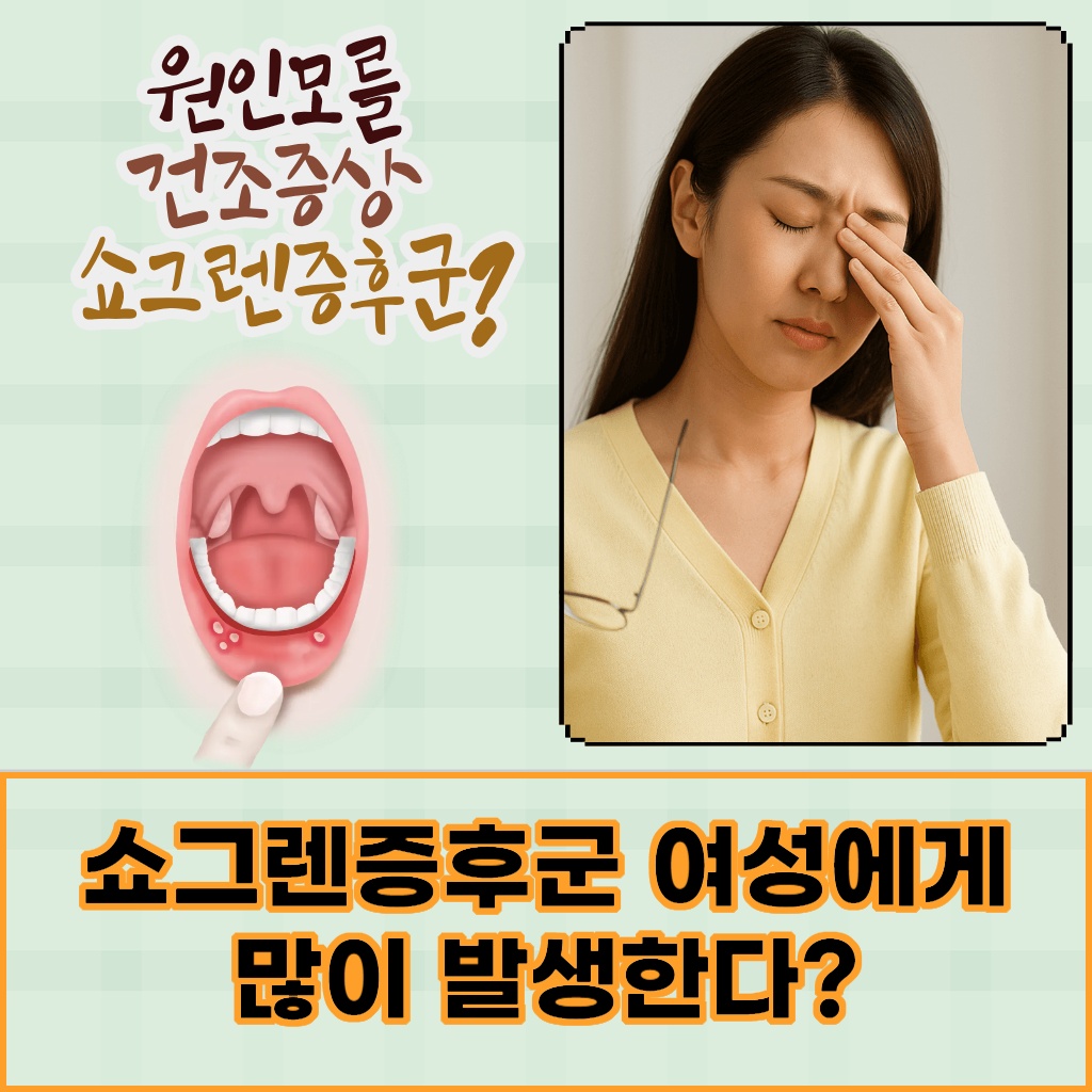 여성에게 많이 발생하는 쇼그렌증후군 설명 이미지
