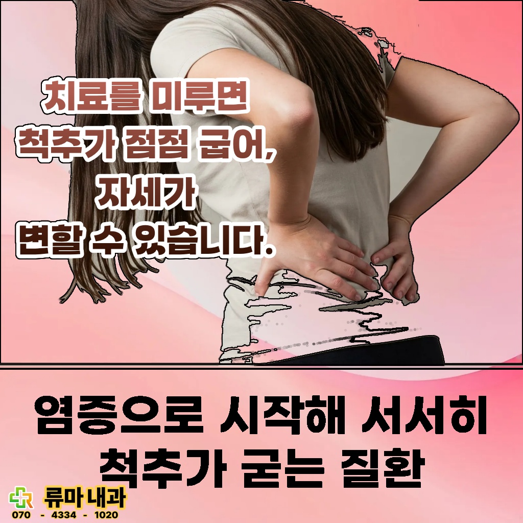 염증으로 시작해 서서히 척추가 굳는 질환 설명 이미지