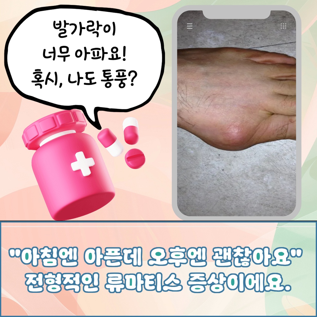 아침에는 아프고 오후에는 괜찮아지는 류마티스 증상 설명 이미지