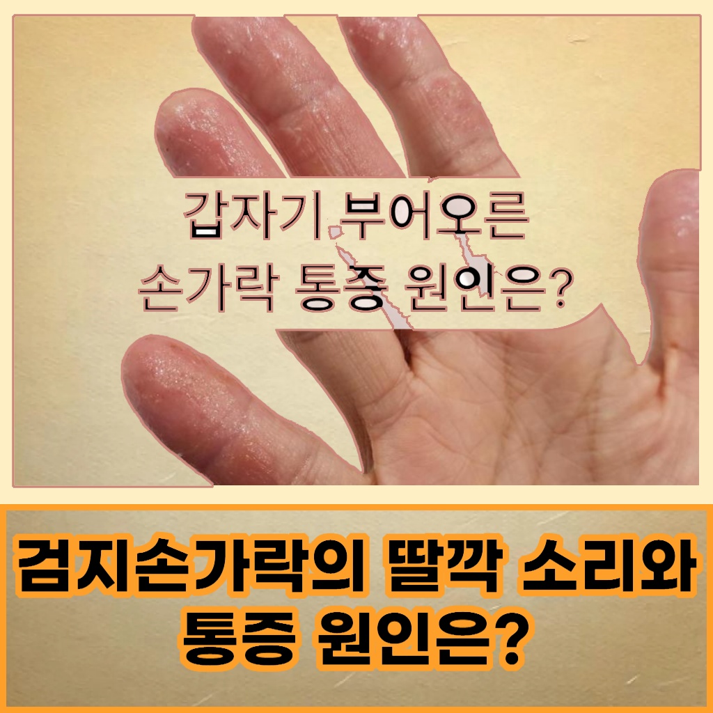 검지손가락에서 딸깍 소리가 나고 통증이 발생하는 원인 설명 이미지
