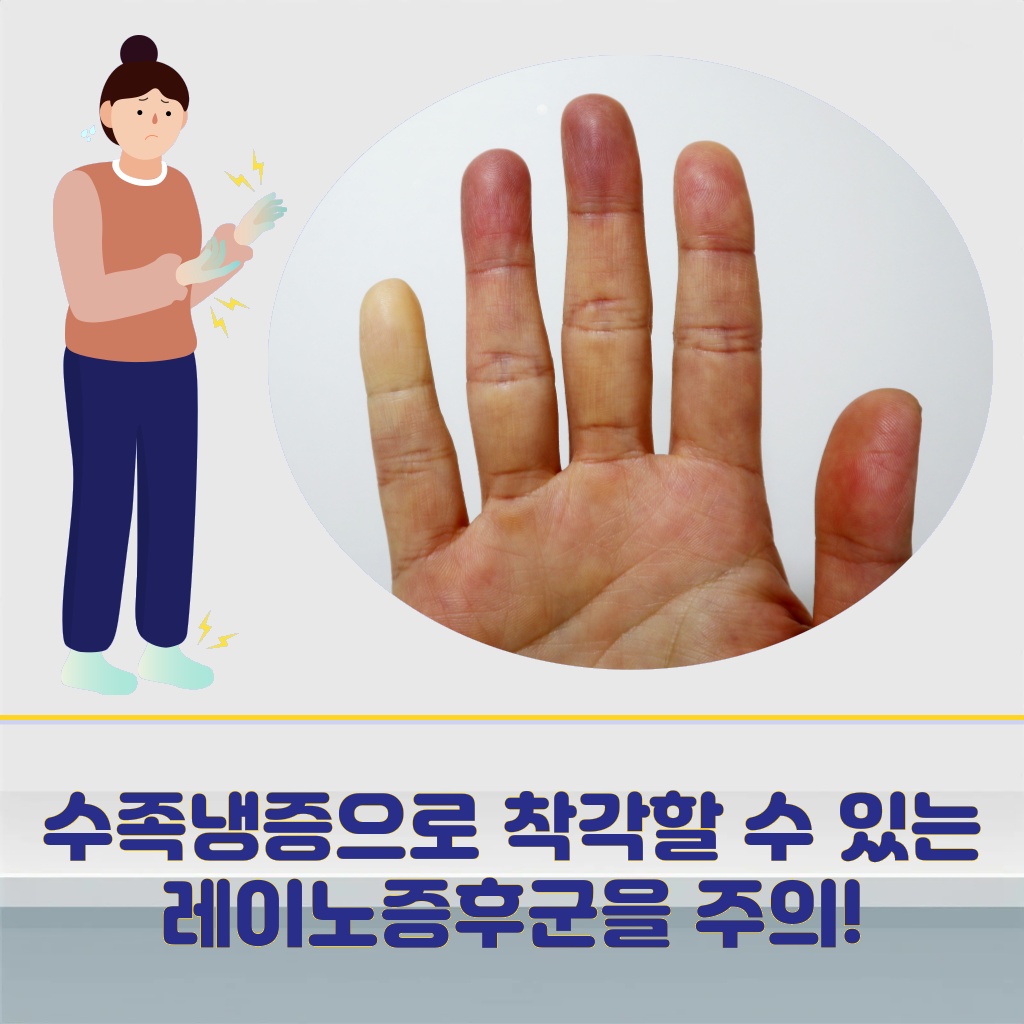 수족냉증으로 착각할 수 있는 레이노증후군 설명 이미지