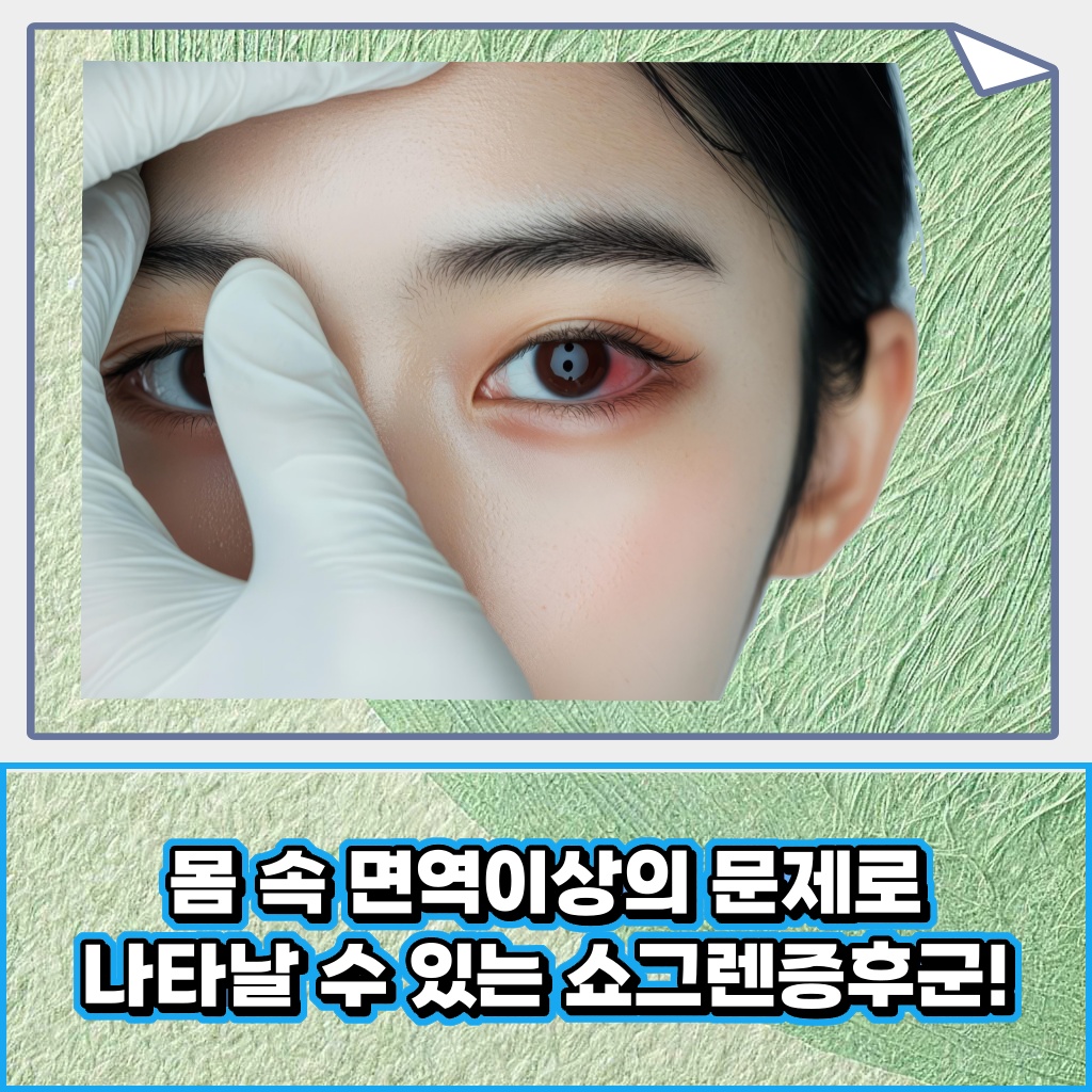 몸속 면역 이상의 문제로 나타날 수 있는 쇼그렌증후군 설명 이미지
