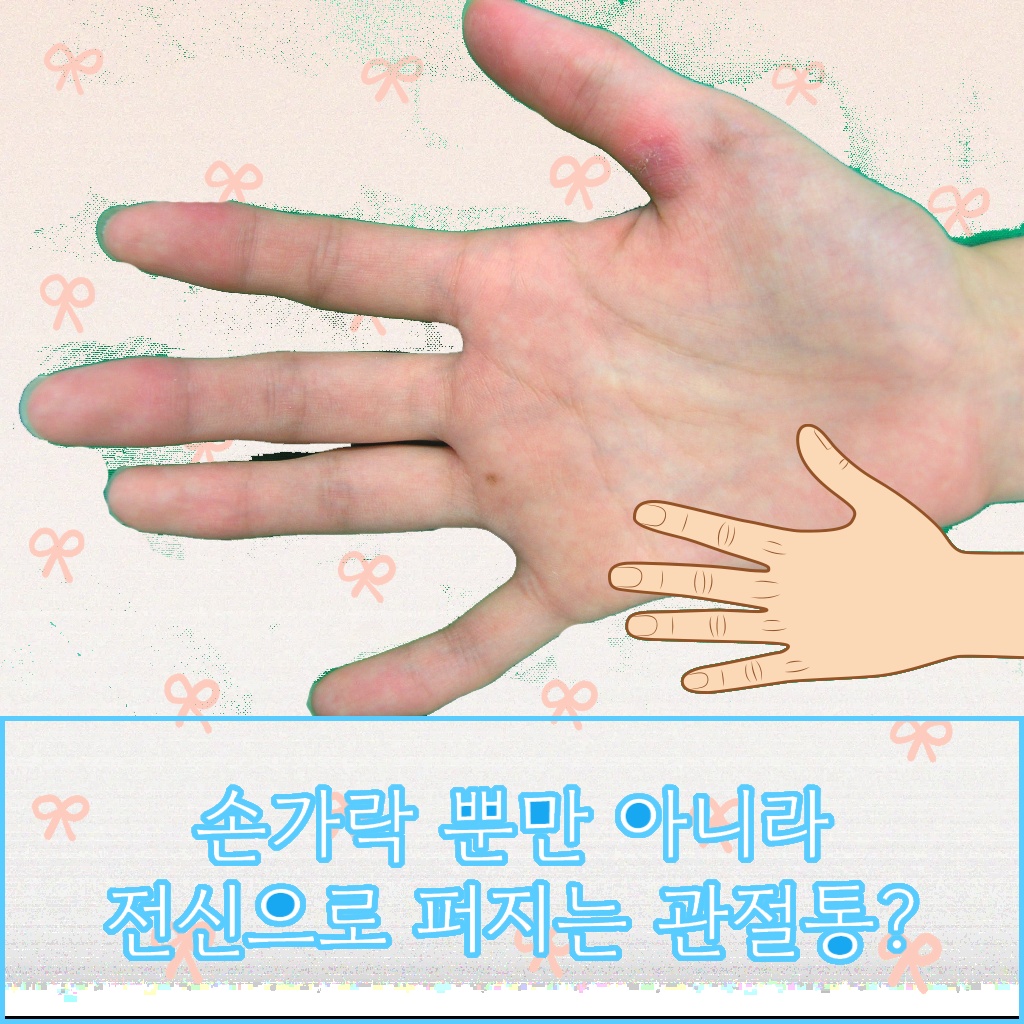 손가락뿐만 아니라 전신으로 퍼지는 관절통 증상 설명 이미지