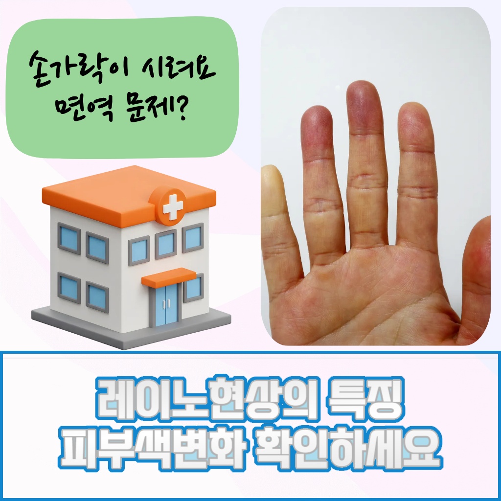 피부색 변화가 특징인 레이노현상 설명 이미지