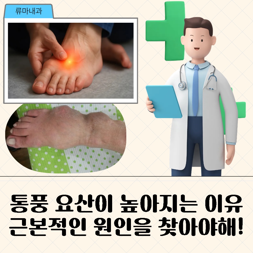 요산이 높아져 통풍이 생기는 근본적인 원인에 대한 설명 이미지