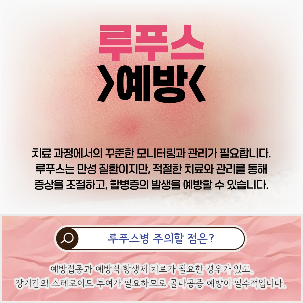 루푸스병 치료 시 예방접종과 예방적 항생제 치료가 필요할 수 있으며, 장기 스테로이드 복용에 따른 골다공증 예방이 필수적이라는 주의사항을 설명하는 이미지