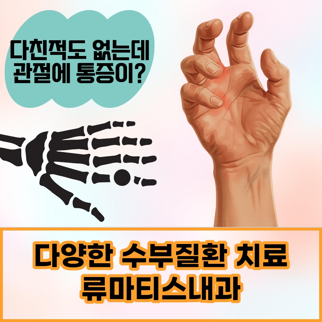 다양한 수부 질환 치료를 위한 류마티스내과 진료 설명 이미지
