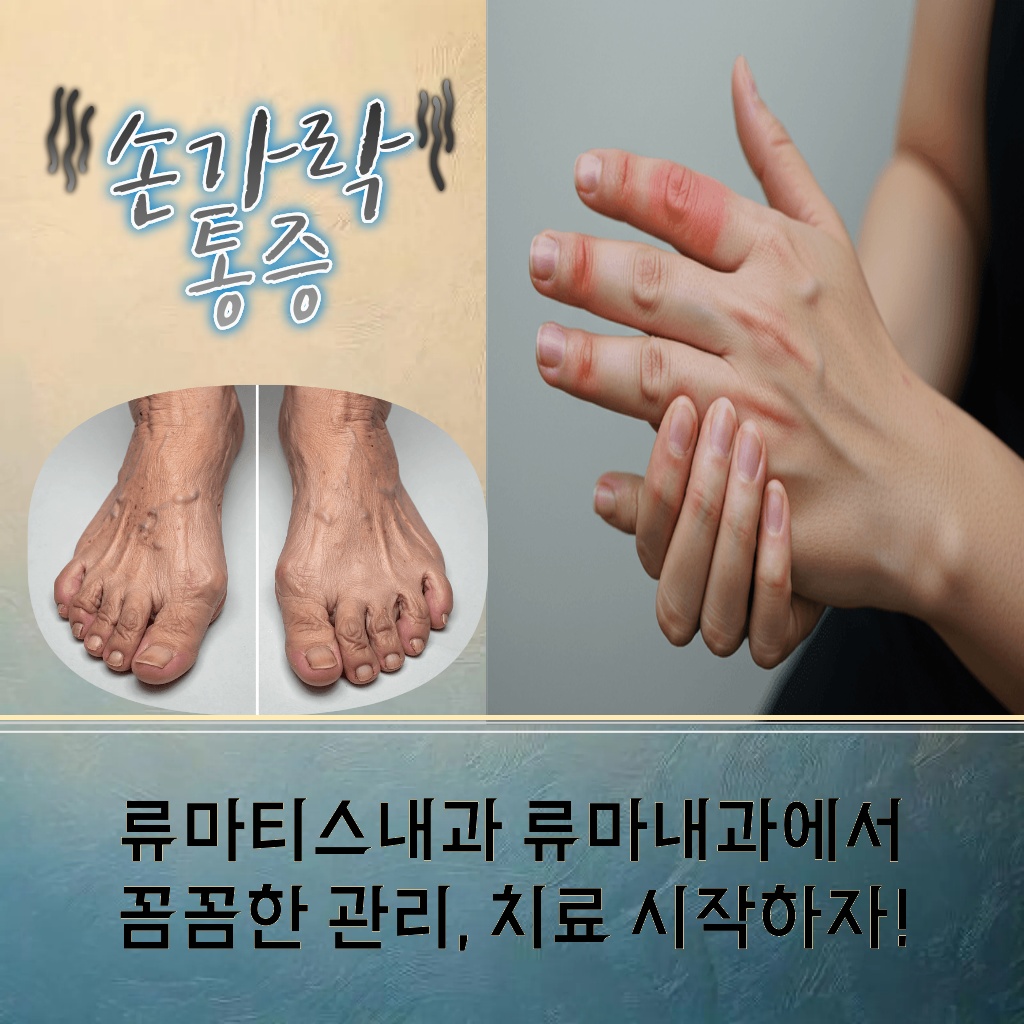류마티스내과에서 꼼꼼한 관리와 치료가 필요한 손가락 통증 설명 이미지