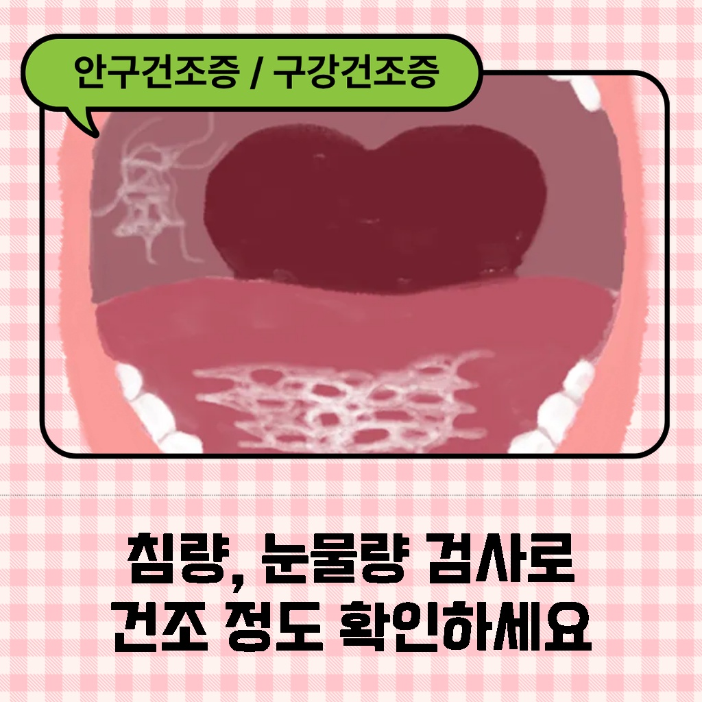 침량과 눈물량 검사로 건조 정도를 확인하는 설명 이미지