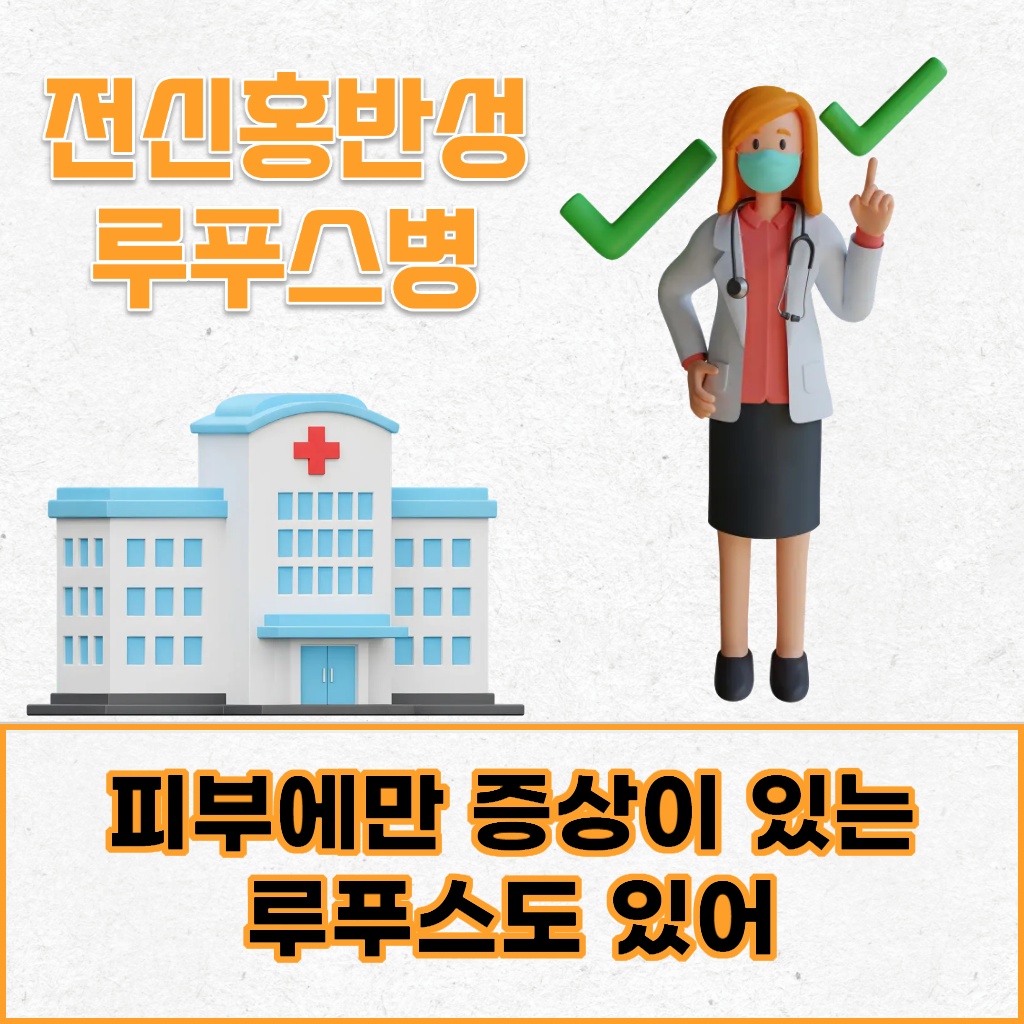 피부에만 증상이 나타나는 루푸스도 존재함을 알려주는 설명 이미지
