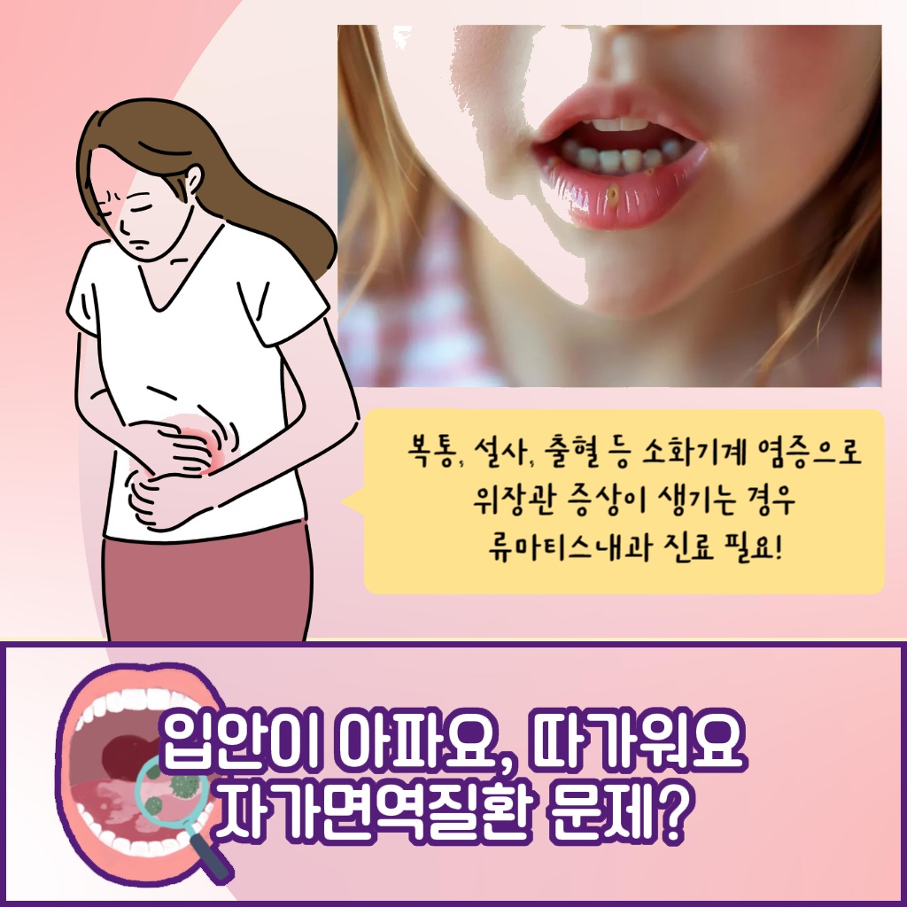 입안이 아프고 따가운 증상이 자가면역질환의 문제일 수 있음을 나타내는 설명 이미지